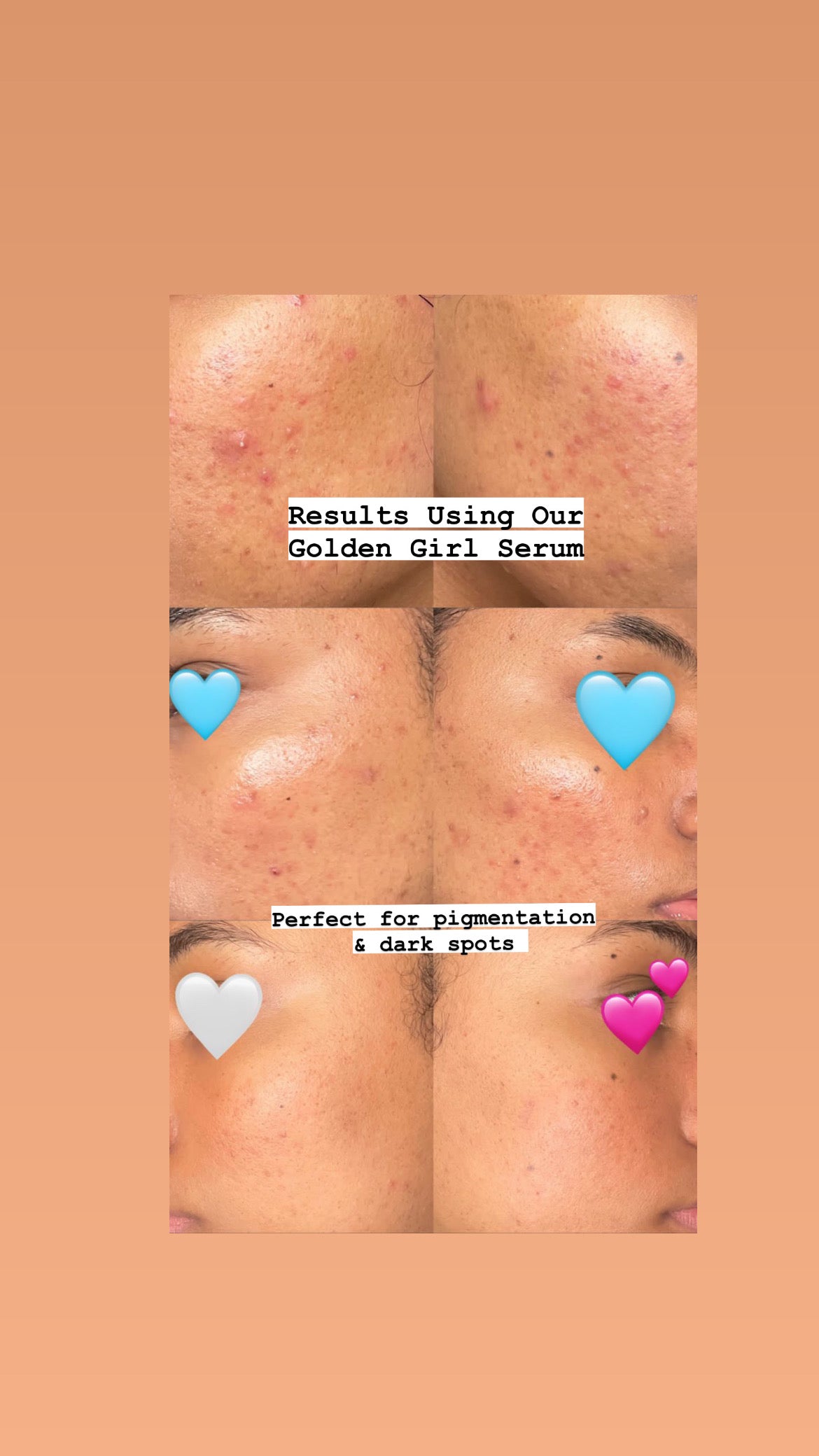 Pigmentation & Dark Spots Serum - Golden Girl
